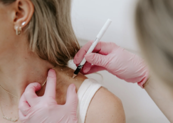 Tiêm botox để có bờ vai búp bê Barbie