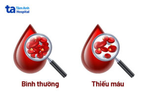 thieu mau